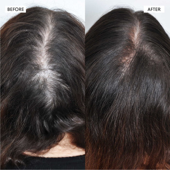 The Kiora Club Hair Growth Spray