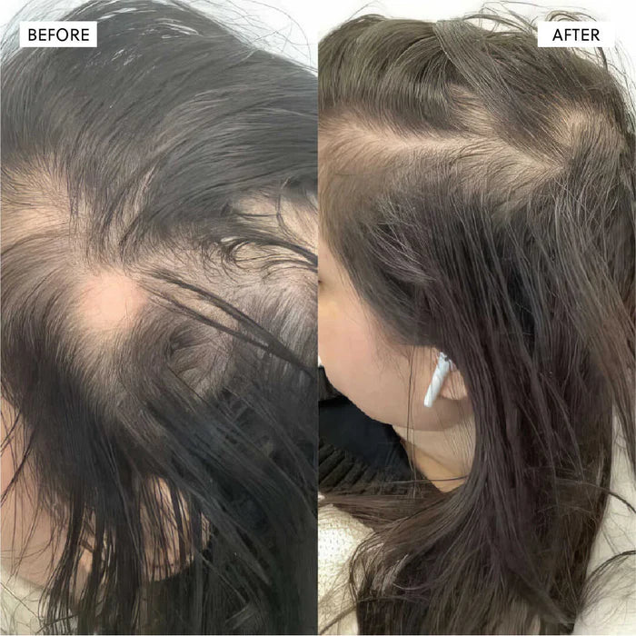 The Kiora Club Hair Growth Spray