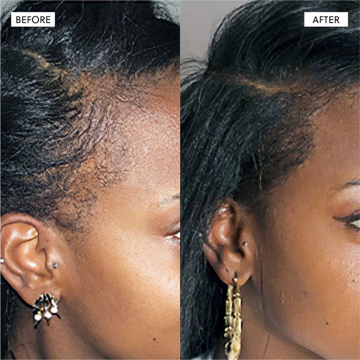 The Kiora Club Hair Growth Spray